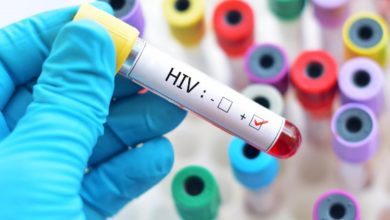 Hình ảnh mô tả xét nghiệm HIV dương tính